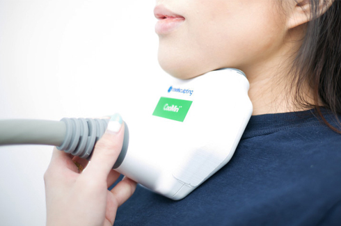 criolipólise na papada com coolsculpting